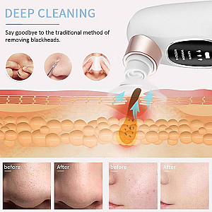 Electric Blackhead Remover Pore Vacuum Cleaner